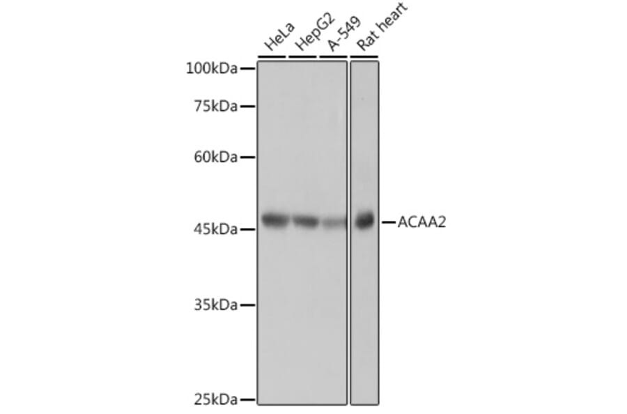 Western Blot - Anti-ACAA2 Antibody [ARC2533] (A81207) - Antibodies.com
