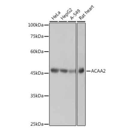 Western Blot - Anti-ACAA2 Antibody [ARC2533] (A81207) - Antibodies.com