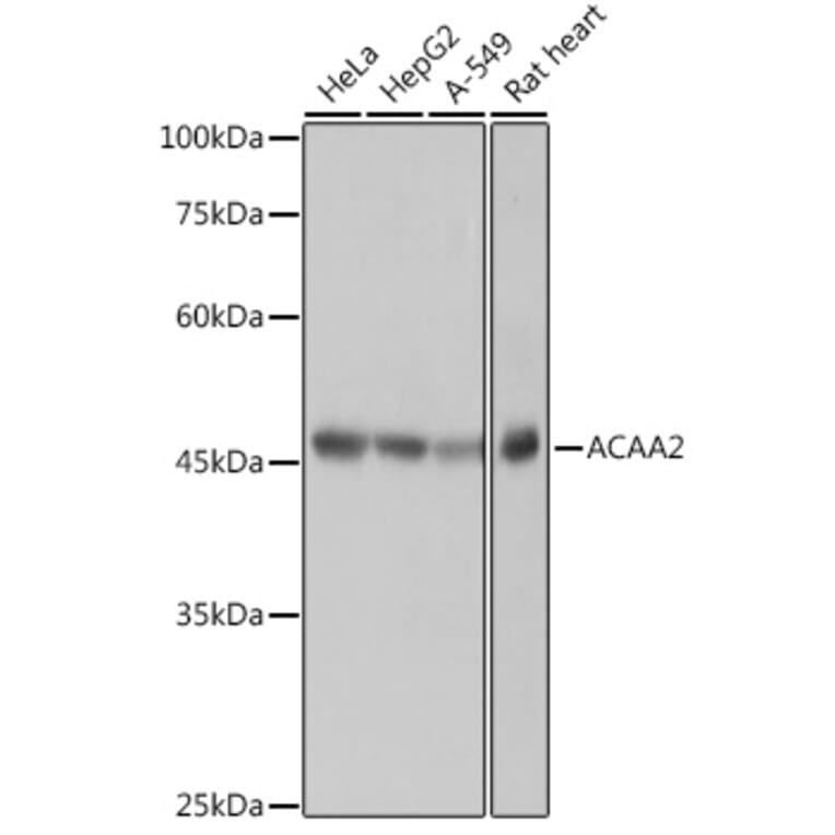 Western Blot - Anti-ACAA2 Antibody [ARC2533] (A81207) - Antibodies.com