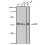 Western Blot - Anti-ACAA2 Antibody [ARC2533] (A81207) - Antibodies.com