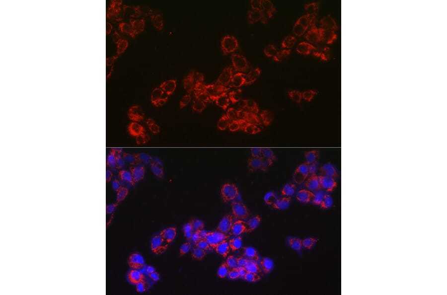 Immunofluorescence - Anti-ACAA2 Antibody [ARC2533] (A81207) - Antibodies.com