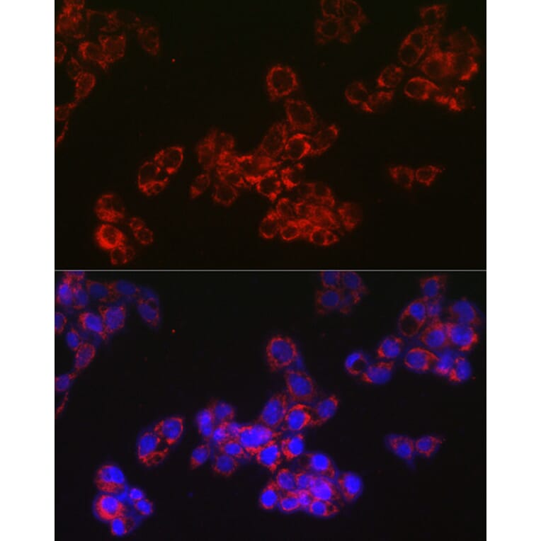 Immunofluorescence - Anti-ACAA2 Antibody [ARC2533] (A81207) - Antibodies.com
