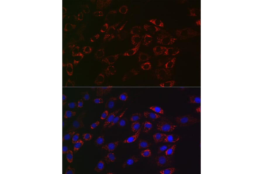 Immunofluorescence - Anti-ACAA2 Antibody [ARC2533] (A81207) - Antibodies.com