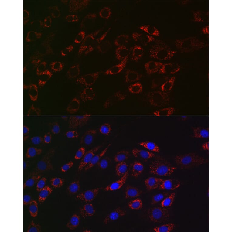 Immunofluorescence - Anti-ACAA2 Antibody [ARC2533] (A81207) - Antibodies.com
