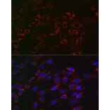Immunofluorescence - Anti-ACAA2 Antibody [ARC2533] (A81207) - Antibodies.com
