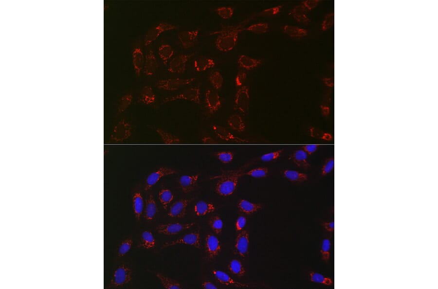 Immunofluorescence - Anti-ACAA2 Antibody [ARC2533] (A81207) - Antibodies.com