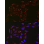 Immunofluorescence - Anti-ACAA2 Antibody [ARC2533] (A81207) - Antibodies.com