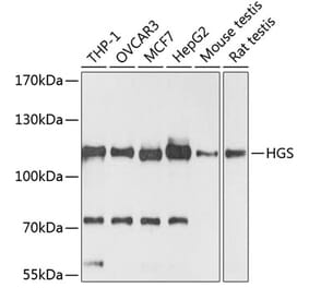 Western Blot - Anti-HGS Antibody (A81208) - Antibodies.com