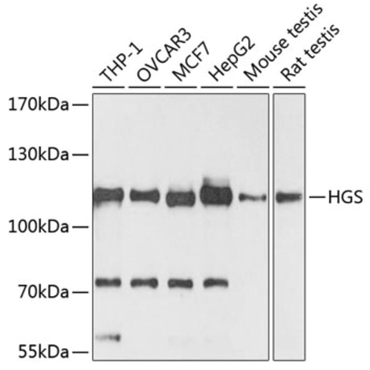 Western Blot - Anti-HGS Antibody (A81208) - Antibodies.com