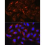Immunofluorescence - Anti-HGS Antibody (A81208) - Antibodies.com