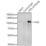 Western Blot - Anti-HGS Antibody (A81208) - Antibodies.com