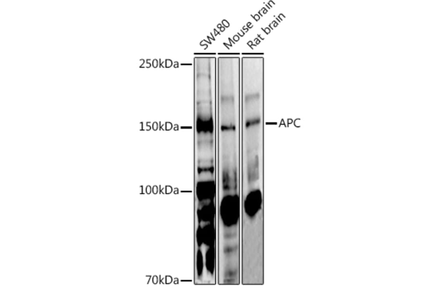 Western Blot - Anti-APC Antibody (A81209) - Antibodies.com