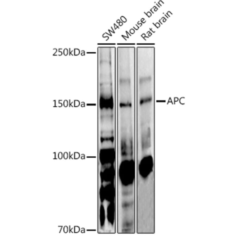 Western Blot - Anti-APC Antibody (A81209) - Antibodies.com