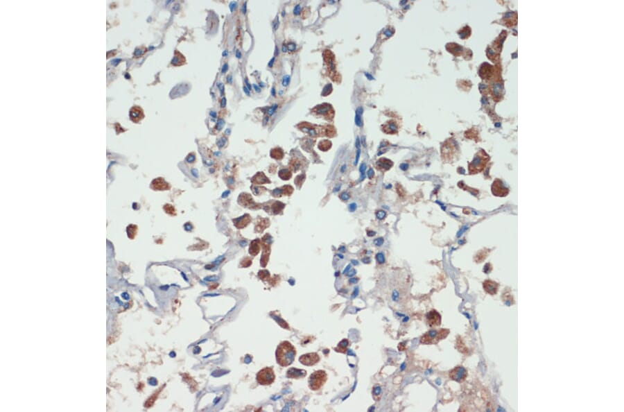 Immunohistochemistry - Anti-APC Antibody (A81209) - Antibodies.com