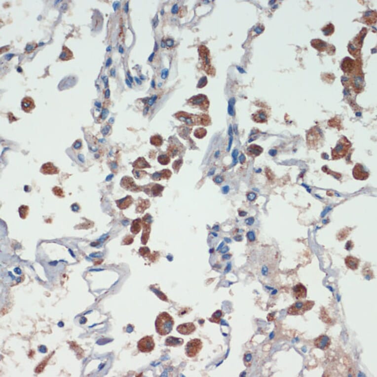 Immunohistochemistry - Anti-APC Antibody (A81209) - Antibodies.com