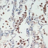 Immunohistochemistry - Anti-APC Antibody (A81209) - Antibodies.com