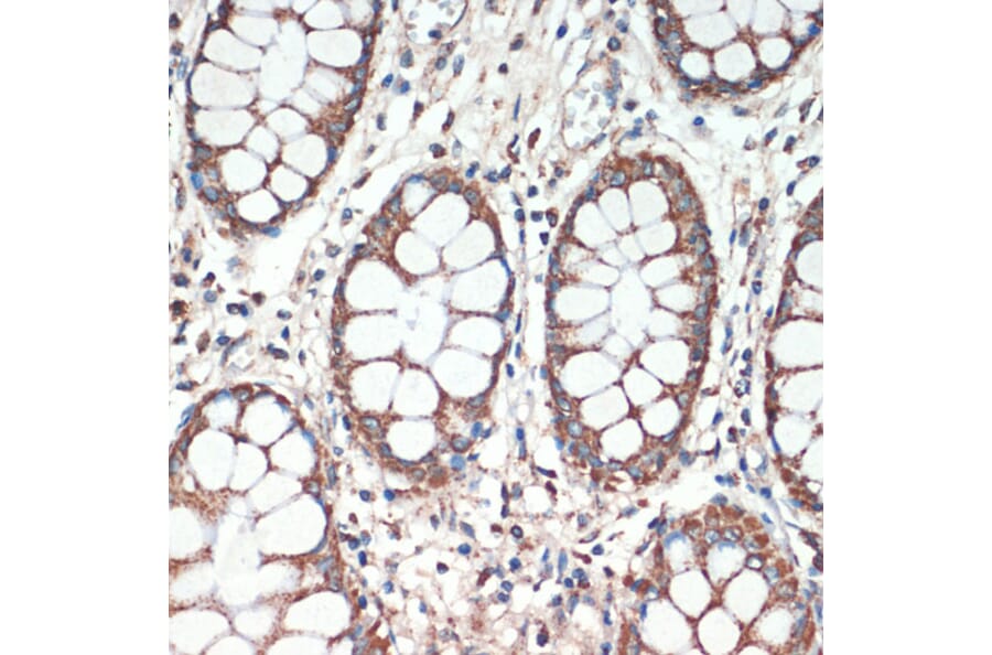 Immunohistochemistry - Anti-APC Antibody (A81209) - Antibodies.com