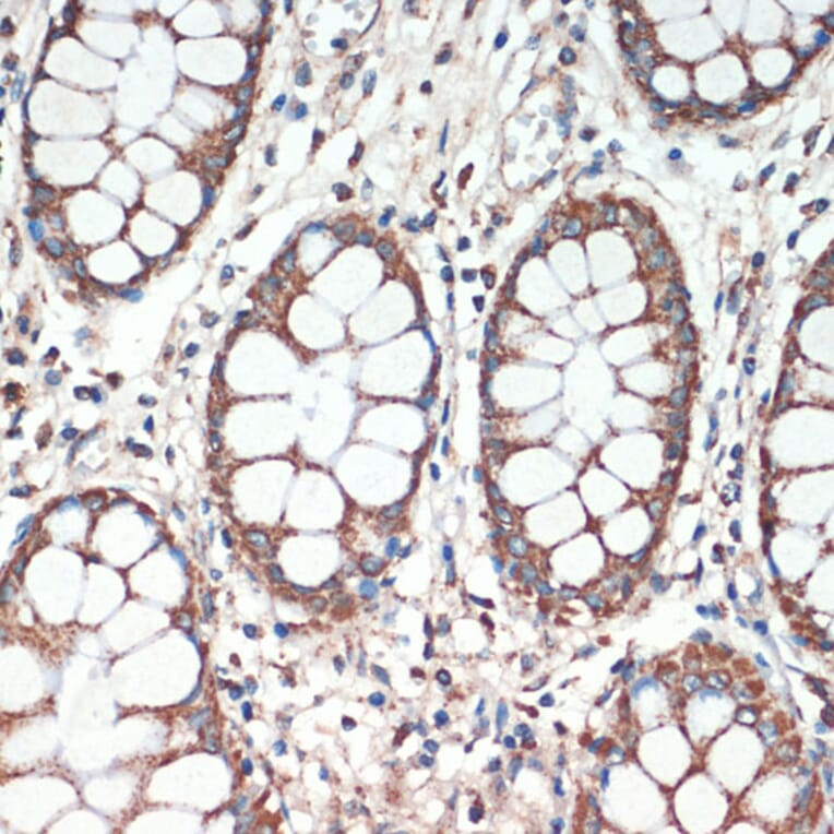 Immunohistochemistry - Anti-APC Antibody (A81209) - Antibodies.com