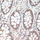 Immunohistochemistry - Anti-APC Antibody (A81209) - Antibodies.com