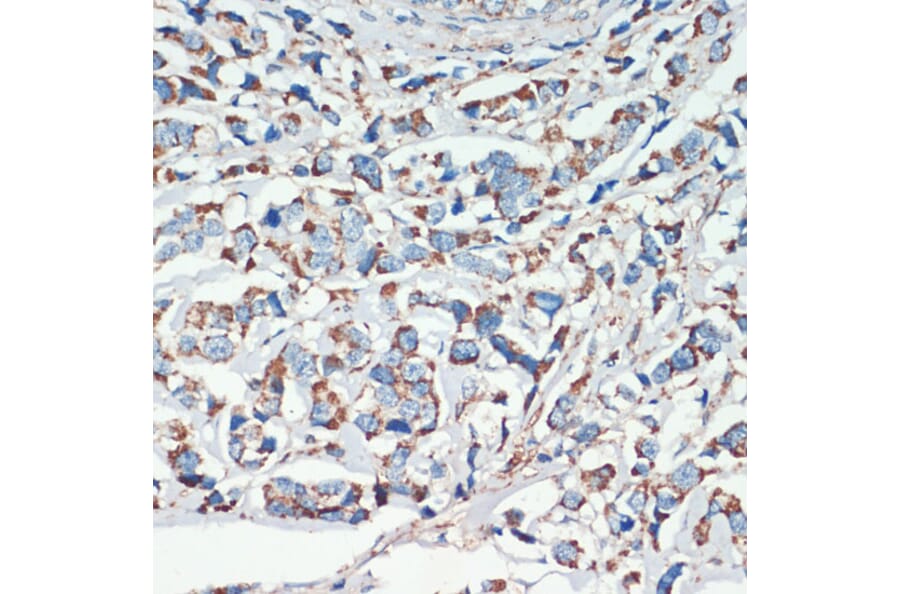 Immunohistochemistry - Anti-APC Antibody (A81209) - Antibodies.com