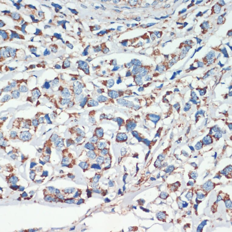 Immunohistochemistry - Anti-APC Antibody (A81209) - Antibodies.com