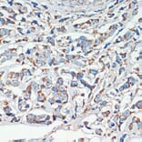 Immunohistochemistry - Anti-APC Antibody (A81209) - Antibodies.com