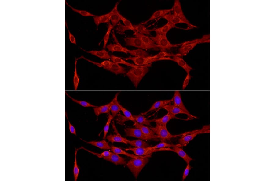 Immunofluorescence - Anti-APC Antibody (A81209) - Antibodies.com