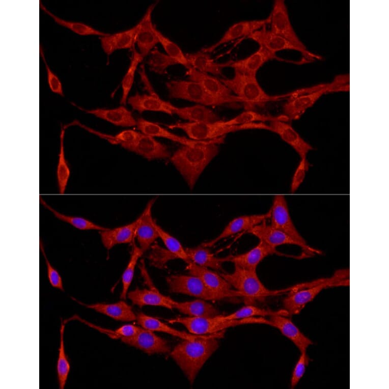 Immunofluorescence - Anti-APC Antibody (A81209) - Antibodies.com