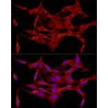 Immunofluorescence - Anti-APC Antibody (A81209) - Antibodies.com