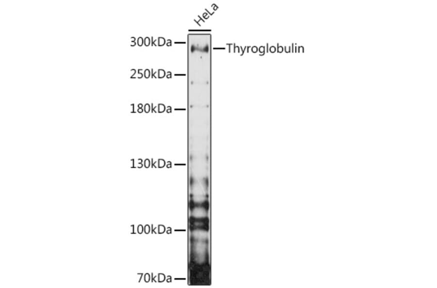 Western Blot - Anti-Thyroglobulin Antibody (A81211) - Antibodies.com