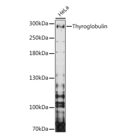 Western Blot - Anti-Thyroglobulin Antibody (A81211) - Antibodies.com
