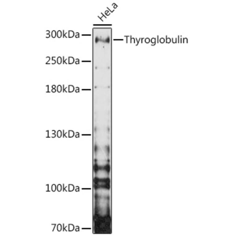 Western Blot - Anti-Thyroglobulin Antibody (A81211) - Antibodies.com