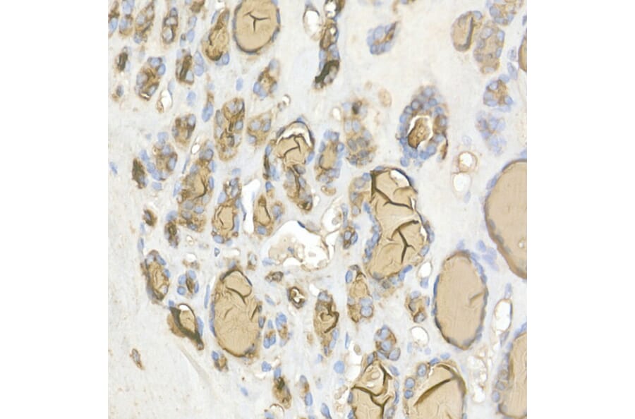 Immunohistochemistry - Anti-Thyroglobulin Antibody (A81211) - Antibodies.com