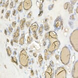 Immunohistochemistry - Anti-Thyroglobulin Antibody (A81211) - Antibodies.com