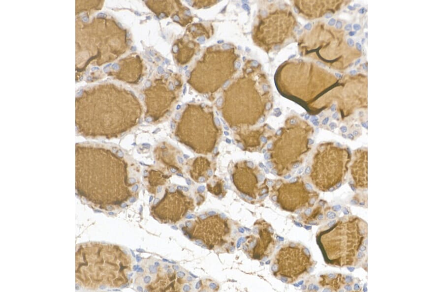 Immunohistochemistry - Anti-Thyroglobulin Antibody (A81211) - Antibodies.com