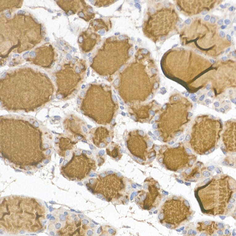 Immunohistochemistry - Anti-Thyroglobulin Antibody (A81211) - Antibodies.com