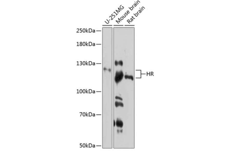 Western Blot - Anti-Hairless Antibody (A81212) - Antibodies.com