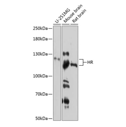 Western Blot - Anti-Hairless Antibody (A81212) - Antibodies.com