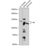 Western Blot - Anti-Hairless Antibody (A81212) - Antibodies.com