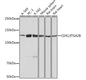 Western Blot - Anti-CD41 Antibody [ARC0620] (A81216) - Antibodies.com