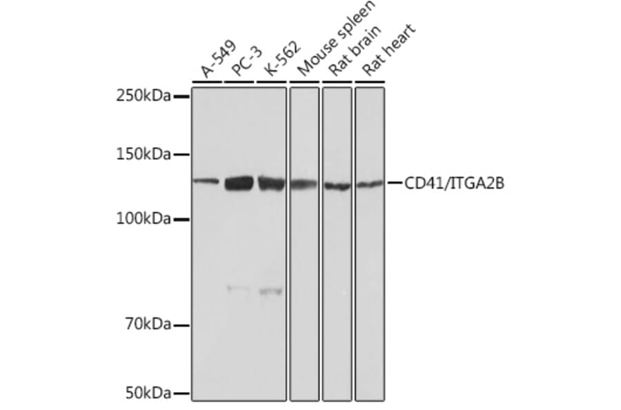 Western Blot - Anti-CD41 Antibody [ARC0620] (A81216) - Antibodies.com