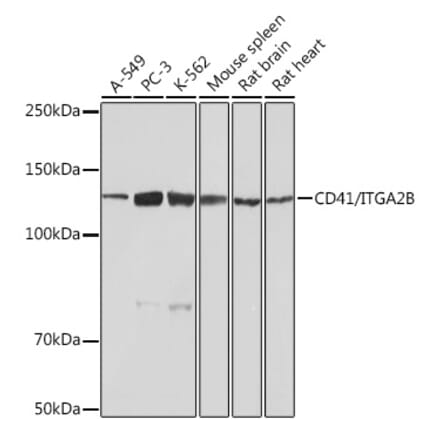 Western Blot - Anti-CD41 Antibody [ARC0620] (A81216) - Antibodies.com
