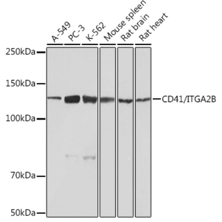 Western Blot - Anti-CD41 Antibody [ARC0620] (A81216) - Antibodies.com