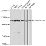 Western Blot - Anti-CD41 Antibody [ARC0620] (A81216) - Antibodies.com