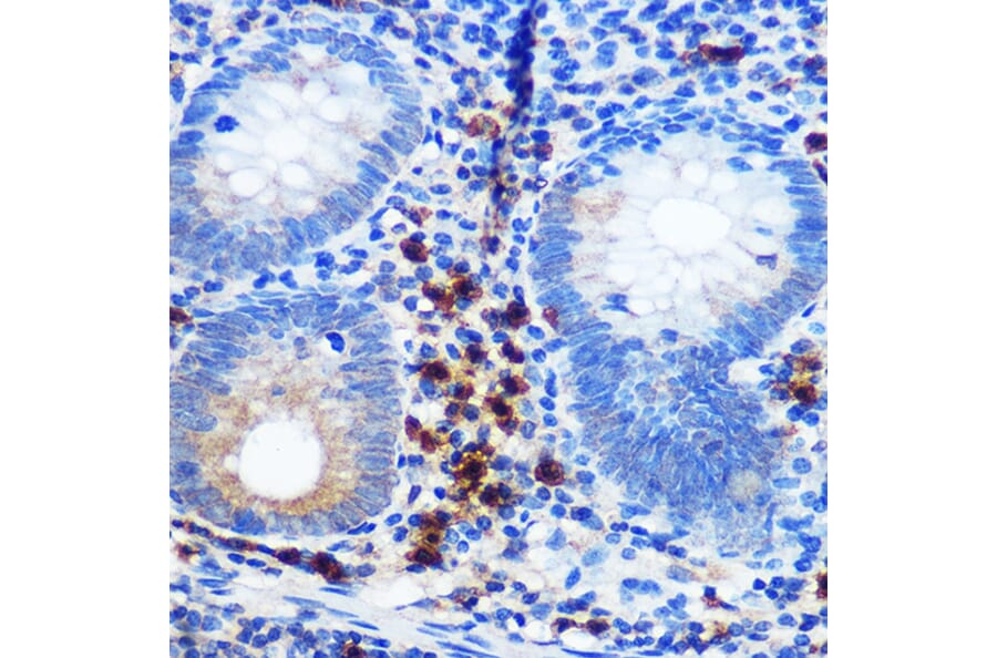 Immunohistochemistry - Anti-CD41 Antibody [ARC0620] (A81216) - Antibodies.com