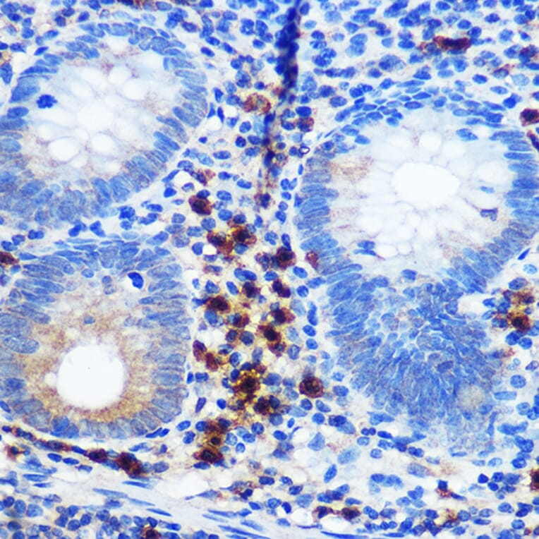 Immunohistochemistry - Anti-CD41 Antibody [ARC0620] (A81216) - Antibodies.com