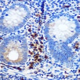 Immunohistochemistry - Anti-CD41 Antibody [ARC0620] (A81216) - Antibodies.com