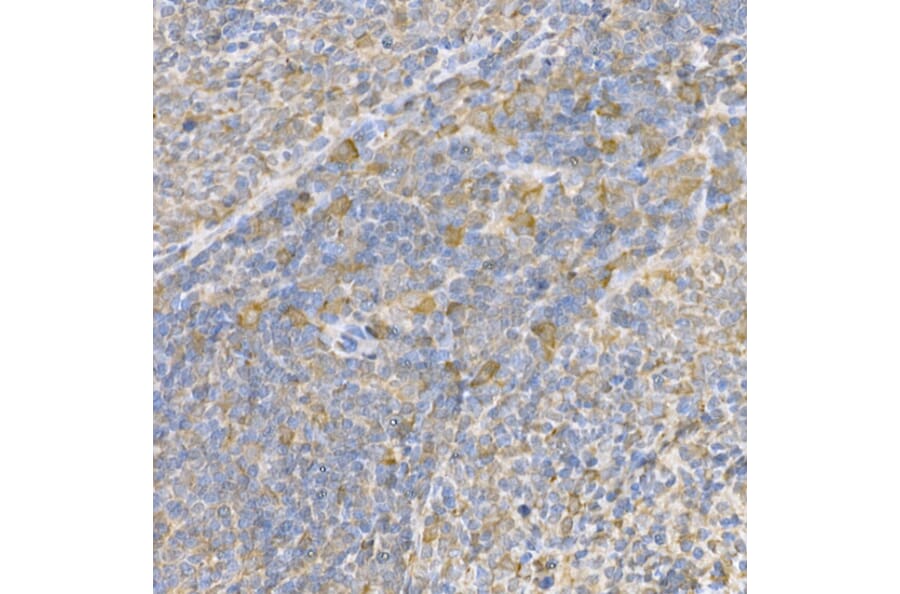 Immunohistochemistry - Anti-Caspase-3 Antibody (A81220) - Antibodies.com