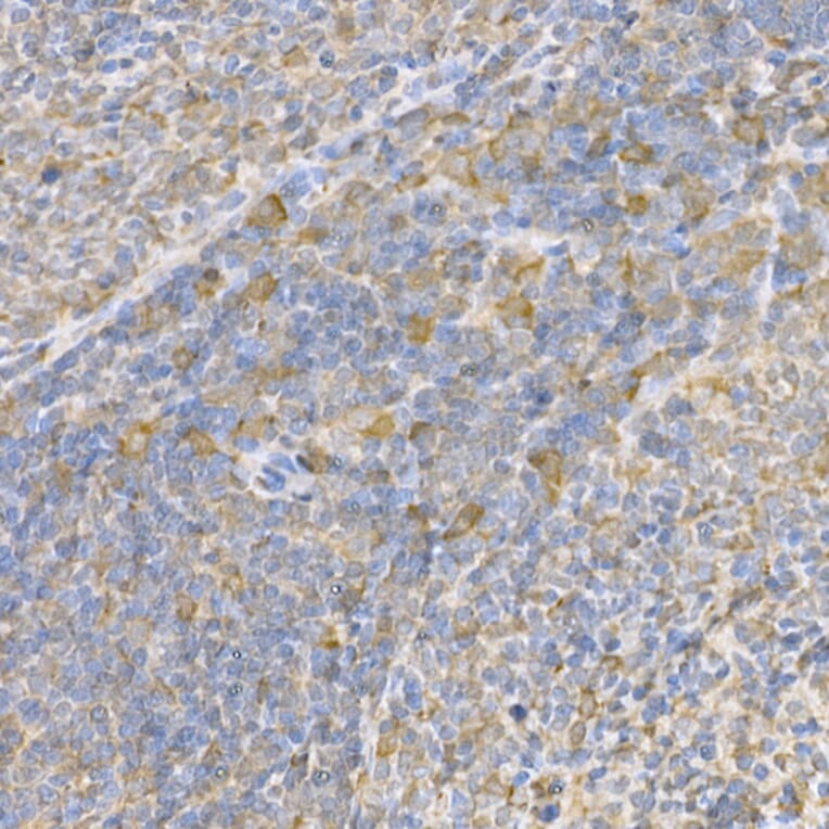 Immunohistochemistry - Anti-Caspase-3 Antibody (A81220) - Antibodies.com