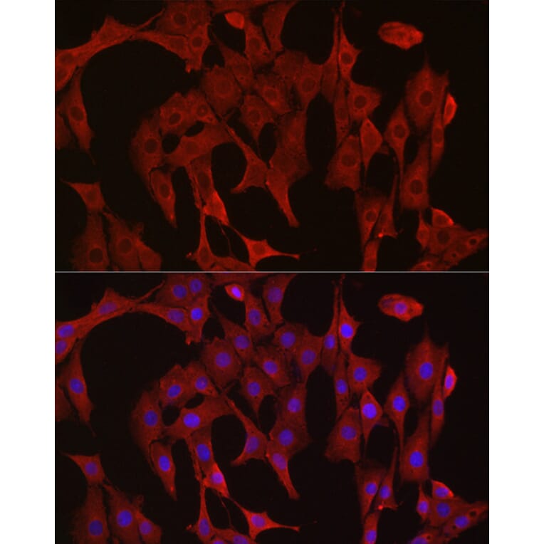 Immunofluorescence - Anti-Caspase-3 Antibody (A81220) - Antibodies.com